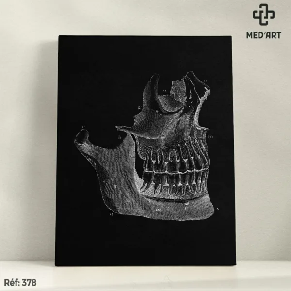 Mâchoire -378