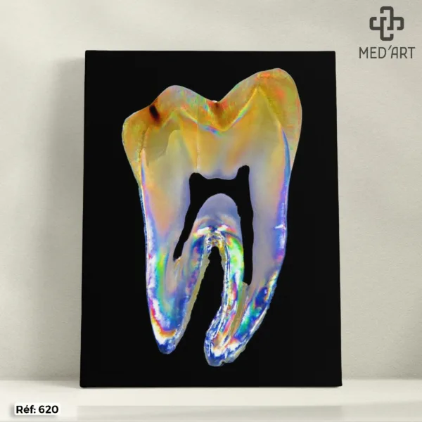Molaire (Dent) -620